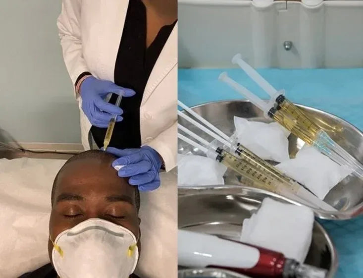 Why Seeing Dermatologists for Hair Loss Is Your Best First Step